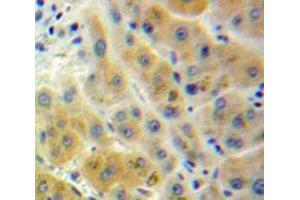 Used in DAB staining on fromalin fixed paraffin-embedded Liver tissue (ADH1 抗体  (AA 25-228))
