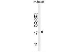 SNR27 Antibody (Center) western blot analysis in mouse heart tissue lysates (35µg/lane). (SNRNP27 抗体  (Middle Region))