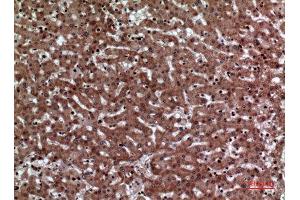 Immunohistochemistry (IHC) analysis of paraffin-embedded Human Liver, antibody was diluted at 1:100. (F11R 抗体  (Internal Region))