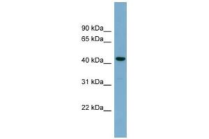 WB Suggested Anti-CDCA7L Antibody Titration: 0. (CDCA7L 抗体  (Middle Region))