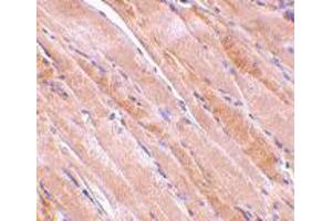 Immunohistochemistry of EMD in human skeletal muscle tissue with EMD polyclonal antibody  at 2. (Emerin 抗体  (N-Term))