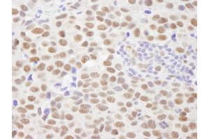 anti-Protein Phosphatase, Mg2+/Mn2+ Dependent, 1G (PPM1G) (AA 400-450) antibody