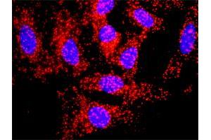 Proximity Ligation Analysis of protein-protein interactions between TGFB1 and APP. (APP 抗体  (AA 19-305))