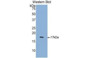 WB of Protein Standard: different control antibodies against Highly purified E. (Cathepsin D ELISA 试剂盒)