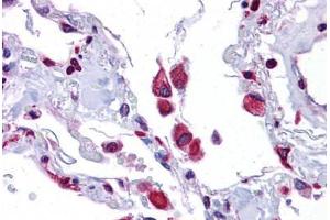 Human Lung: Formalin-Fixed, Paraffin-Embedded (FFPE) (EIF2AK1 抗体  (AA 108-157))