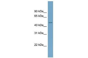 ACVR2B antibody used at 1 ug/ml to detect target protein. (ACVR2B 抗体  (Middle Region))