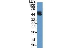 Detection of a1AGP in Human Lung lysate using Polyclonal Antibody to Alpha-1-Acid Glycoprotein (a1AGP) (ORM1 抗体  (AA 19-201))