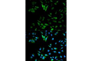 Immunofluorescence analysis of HeLa cells using ENO1 antibody. (ENO1 抗体)