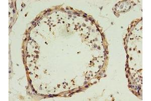 Immunohistochemistry of paraffin-embedded human testis tissue using ABIN7149824 at dilution of 1:100 (DPPA4 抗体  (AA 11-264))