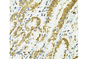 Immunohistochemistry of paraffin-embedded Human esophagus using HLA-DQA1 Polyclonal Antibody at dilution of 1:100 (40x lens). (HLA-DQA1 抗体)