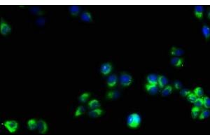 Immunofluorescence staining of PC-3 cells with ABIN7171386 at 1:53, counter-stained with DAPI. (CD3 epsilon 抗体  (AA 23-207))