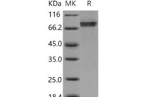 Western Blotting (WB) image for Fibroblast Growth Factor Receptor 1 (FGFR1) protein (GST tag,His tag) (ABIN7317102)