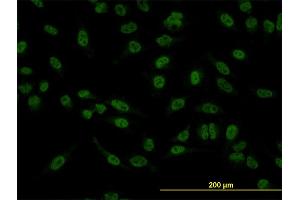 Immunofluorescence of monoclonal antibody to SMAD5 on HeLa cell. (SMAD5 抗体  (AA 105-182))