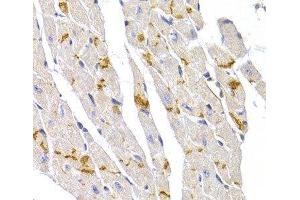 Immunohistochemistry of paraffin-embedded Mouse heart using Desmoplakin Polyclonal Antibody at dilution of 1:100 (40x lens).