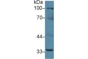 Western blot analysis of Mouse Liver lysate, using Mouse RANk Antibody (2 µg/ml) and HRP-conjugated Goat Anti-Rabbit antibody ( (TNFRSF11A 抗体  (AA 359-542))