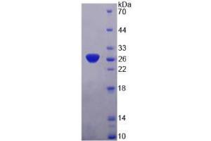 SDS-PAGE analysis of SNAP25 Protein. (SNAP25 蛋白)