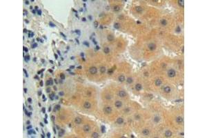 Used in DAB staining on fromalin fixed paraffin-embedded liver tissue (MMP15 抗体  (AA 280-497))