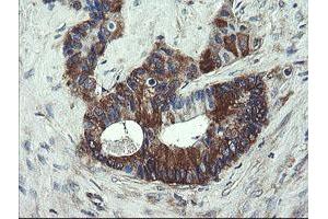 Image no. 6 for anti-Prefoldin Subunit 3 (PFDN3) antibody (ABIN1501704)