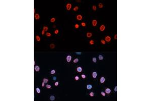 Immunofluorescence analysis of HeLa cells using CDKN1A/p21CIP1 antibody (ABIN3022005, ABIN3022006, ABIN3022007 and ABIN6218565) at dilution of 1:100. (p21 抗体  (AA 43-142))