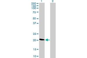 Western Blot analysis of DIRAS1 expression in transfected 293T cell line by DIRAS1 MaxPab polyclonal antibody.