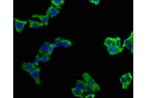 Immunofluorescence staining of HepG2 cells with ABIN7139751 at 1:100, counter-stained with DAPI. (CAMK2N1 抗体  (AA 9-27))