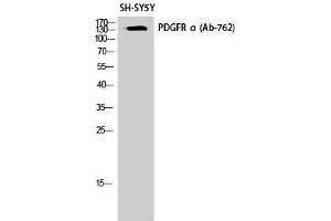 Western Blotting (WB) image for anti-Platelet Derived Growth Factor Receptor alpha (PDGFRA) (Thr210) antibody (ABIN3186366) (PDGFRA 抗体  (Thr210))