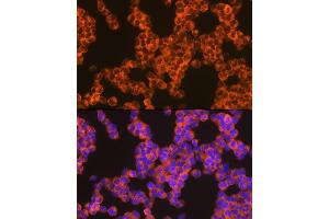 Immunofluorescence analysis of Jurkat cells using Oncostatin M Rabbit mAb (ABIN7269099) at dilution of 1:100 (40x lens). (Oncostatin M 抗体)