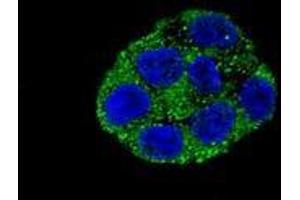 Immunofluorescence (IF) image for anti-Phospholipase A2, Group VI (Cytosolic, Calcium-Independent) (PLA2G6) (AA 558-588), (Middle Region) antibody (ABIN954164)