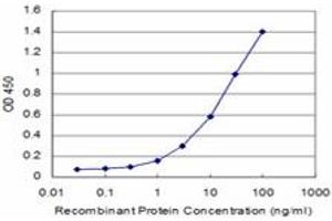 Detection limit for recombinant GST tagged CARF is approximately 1ng/ml as a capture antibody. (CDKN2AIP 抗体  (AA 1-579))