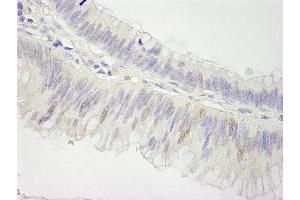 Immunohistochemistry (IHC) image for anti-Cullin 3 (CUL3) (AA 650-700) antibody (ABIN7448504) (Cullin 3 抗体  (AA 650-700))