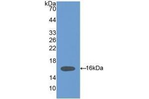 Detection of Recombinant HPA, Mouse using Polyclonal Antibody to Heparanase (HPSE) (HPSE 抗体  (AA 280-412))