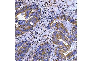 IHC analysis of SWAP70 using anti-SWAP70 antibody (ABIN7600201). (SWAP70 抗体  (AA 161-292))