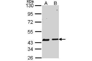 WB Image Sample (30 ug of whole cell lysate) A: A549 B: Hela 10% SDS PAGE antibody diluted at 1:1000 (SERPINB6 抗体  (Internal Region))