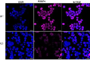 Immunocytochemical staining of HeLa cells using RBBP4 antibody (ABIN7800185), 1:1,000), Top panel: wild-type (WT), Bottom panal: RBBP4 shRNA knockdown (KD). (Recombinant Retinoblastoma Binding Protein 4 抗体)