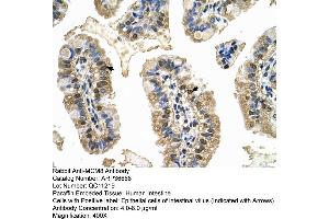 Human Intestine (MCM8 抗体  (C-Term))