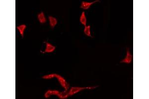 ABIN6274919 staining HeLa by IF/ICC. (BMP3 抗体  (Internal Region))
