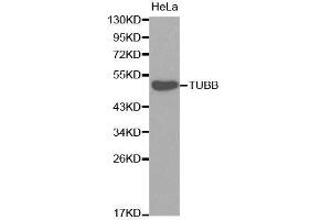 Western blot analysis of extracts of HeLa cells, using TUBB antibody.