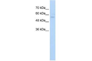 WB Suggested Anti-ZNF19 Antibody Titration:  5.
