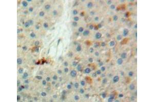 IHC-P analysis of liver tissue, with DAB staining. (LDHB 抗体  (AA 1-334))