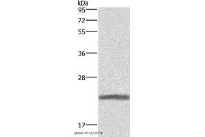 Western blot analysis of Human placenta tissue, using GH1 Polyclonal Antibody at dilution of 1:500 (Growth Hormone 1 抗体)