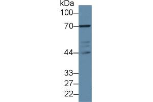 Western blot analysis of Human Jurkat cell lysate, using Rabbit Anti-Mouse LCP2 Antibody (2 µg/ml) and HRP-conjugated Goat Anti-Rabbit antibody (abx400043, 0. (LCP2 抗体  (AA 202-463))