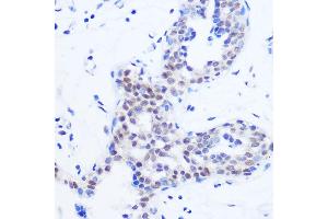 Immunohistochemistry of paraffin-embedded Human breast using SRSF11 Rabbit pAb (ABIN7270215) at dilution of 1:100 (40x lens). (SRSF11 抗体)