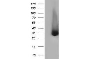 HEK293T cells were transfected with the pCMV6-ENTRY control (Left lane) or pCMV6-ENTRY ERCC1 (Right lane) cDNA for 48 hrs and lysed. (ERCC1 抗体)