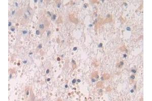 Immunohistochemistry (IHC) image for anti-Spondin 2 (SPON2) (AA 119-331) antibody (ABIN7436018)
