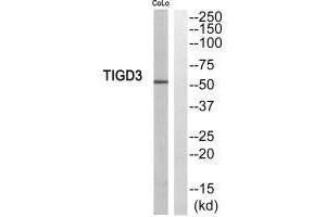 Western blot analysis of extracts from COLO205 cells, using TIGD3 antibody. (TIGD3 抗体  (C-Term))