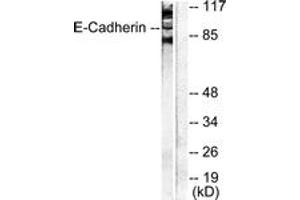Western blot analysis of extracts from NIH-3T3 cells, using Cadherin-pan Antibody. (Cadherin 抗体  (AA 833-882))