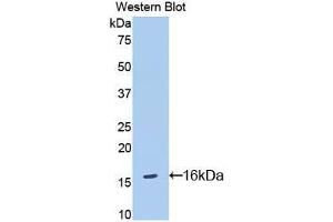 Western blot analysis of the recombinant protein. (IL18R1 抗体  (AA 391-518))