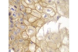 Immunohistochemistry of paraffin-embedded Human esophagus using IL7R Polyclonal Antibody at dilution of 1:100 (40x lens). (IL7R 抗体)