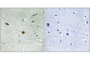 Immunohistochemistry analysis of paraffin-embedded human brain, using Retinoblastoma (Phospho-Ser608) Antibody. (Retinoblastoma Protein (Rb) 抗体  (pSer608))