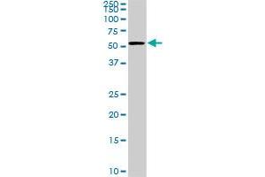 CDK8 monoclonal antibody (M02), clone 6E5. (CDK8 抗体  (AA 375-464))